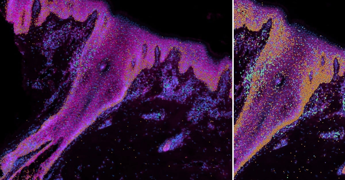 From-Skin-Atlas-Xenium-Wellcom-Sanger-Institute